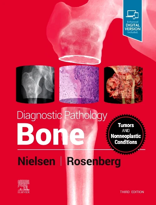 Coperta cărții "Diagnostic Pathology: Bone" de autor necunoscut