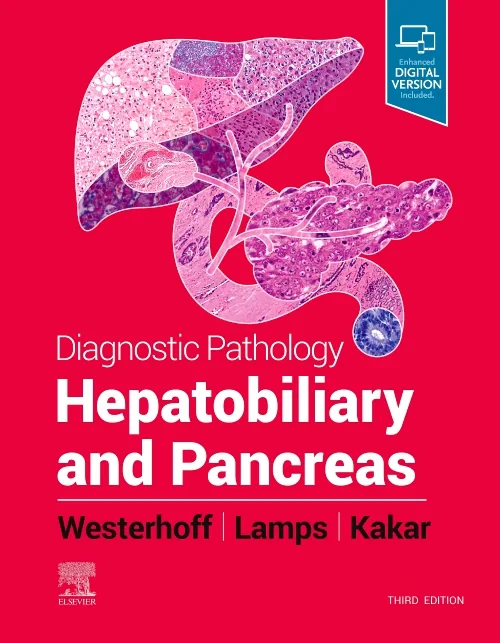 Coperta cărții "Diagnostic Pathology : Hepatobiliary and Pancreas" de autor necunoscut