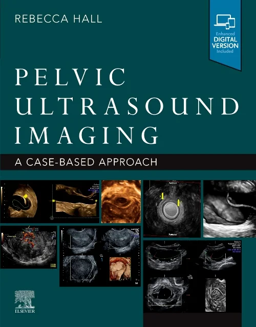 Coperta cărții "Pelvic Ultrasound Imaging" de autor necunoscut
