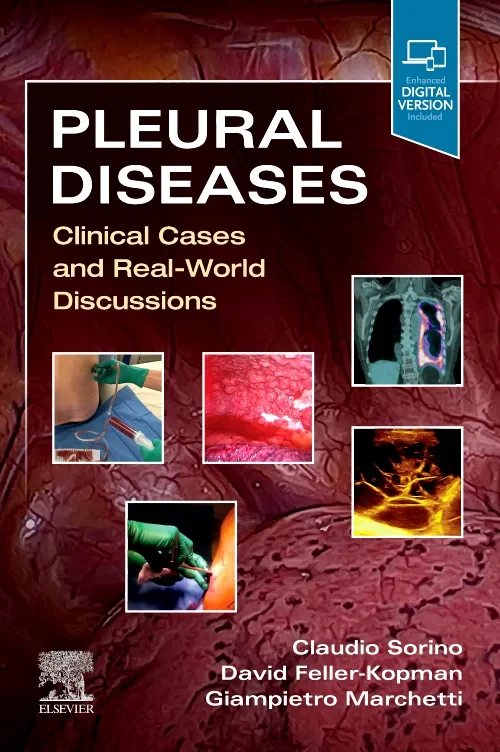 Coperta cărții "Pleural Diseases" de autor necunoscut