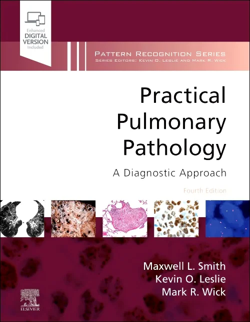 Coperta cărții "Practical Pulmonary Pathology" de autor necunoscut
