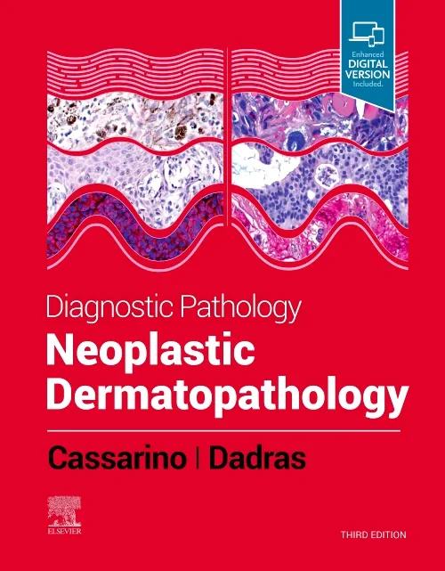Coperta cărții "Diagnostic Pathology: Neoplastic Dermatopathology" de autor necunoscut
