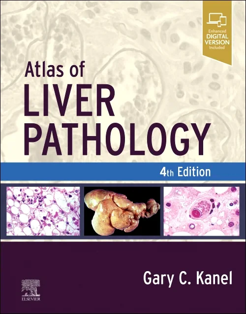 Coperta cărții "Atlas of Liver Pathology" de autor necunoscut