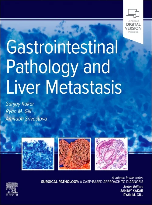 Coperta cărții "Gastrointestinal Pathology and Liver Metastasis: A Case-Based Approach to Diagnosis" de autor necunoscut