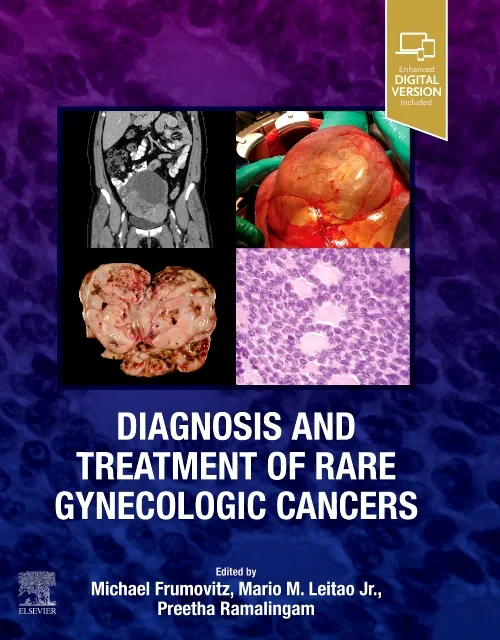 Coperta cărții "Diagnosis and Treatment of Rare Gynecologic Cancers" de autor necunoscut