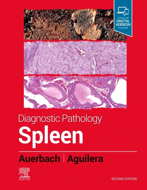 Coperta cărții "Diagnostic Pathology: Spleen" de autor necunoscut
