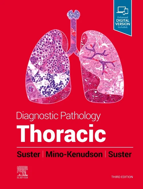 Coperta cărții "Diagnostic Pathology: Thoracic" de autor necunoscut