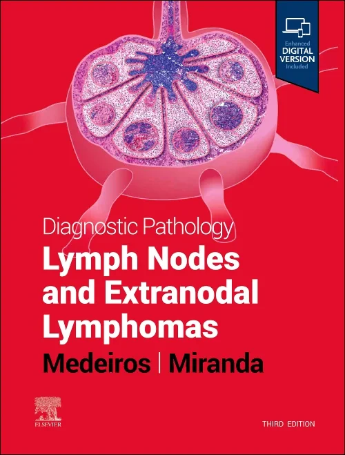Coperta cărții "Diagnostic Pathology: Lymph Nodes and Extranodal Lymphomas" de autor necunoscut