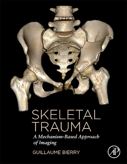 Coperta cărții "Skeletal Trauma" de autor necunoscut