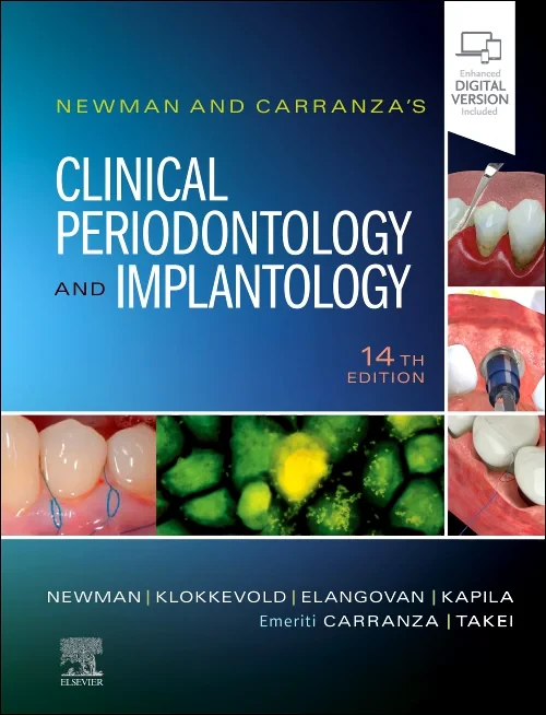 Coperta cărții "Newman and Carranza&#039;s Clinical Periodontology and Implantology" de autor necunoscut