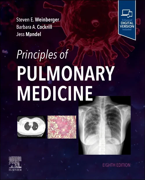 Coperta cărții "Principles of Pulmonary Medicine" de autor necunoscut