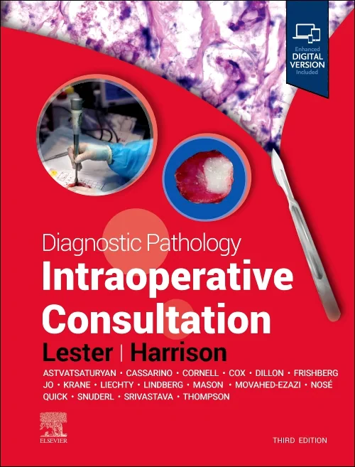 Coperta cărții "Diagnostic Pathology: Intraoperative Consultation" de autor necunoscut