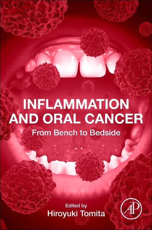 Coperta cărții "Inflammation and Oral Cancer" de autor necunoscut