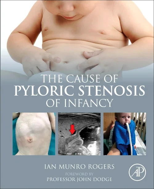 Coperta cărții "The Cause of Pyloric Stenosis of Infancy" de autor necunoscut
