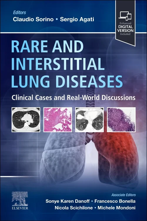Coperta cărții "Rare and Interstitial Lung Diseases" de autor necunoscut