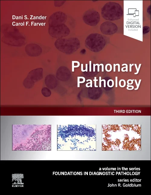 Coperta cărții "Pulmonary Pathology" de autor necunoscut