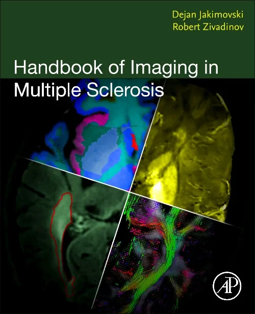 Coperta cărții "Handbook of Imaging in Multiple Sclerosis" de autor necunoscut