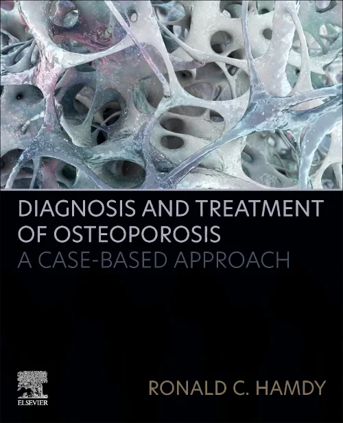 Coperta cărții "Diagnosis and Treatment of Osteoporosis" de autor necunoscut