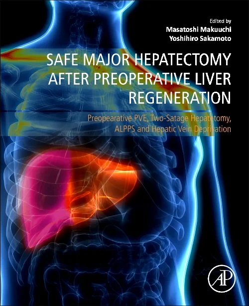 Coperta cărții "Safe Major Hepatectomy after Preoperative Liver Regeneration" de autor necunoscut