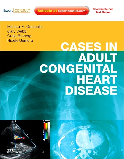 Coperta cărții "Cases in Adult Congenital Heart Disease - Expert Consult: Online and Print" de autor necunoscut