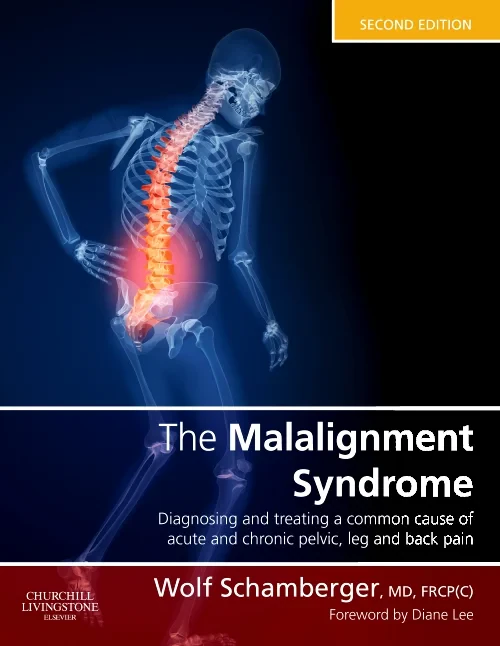 Coperta cărții "The Malalignment Syndrome" de autor necunoscut
