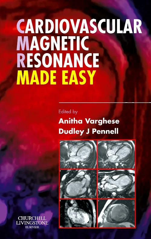 Coperta cărții "Cardiovascular Magnetic Resonance Made Easy" de autor necunoscut