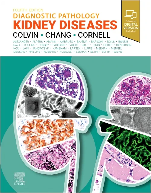 Coperta cărții "Diagnostic Pathology: Kidney Diseases" de autor necunoscut