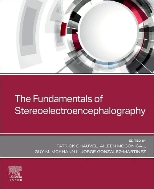 Coperta cărții "The Fundamentals of Stereoelectroencephalography" de autor necunoscut