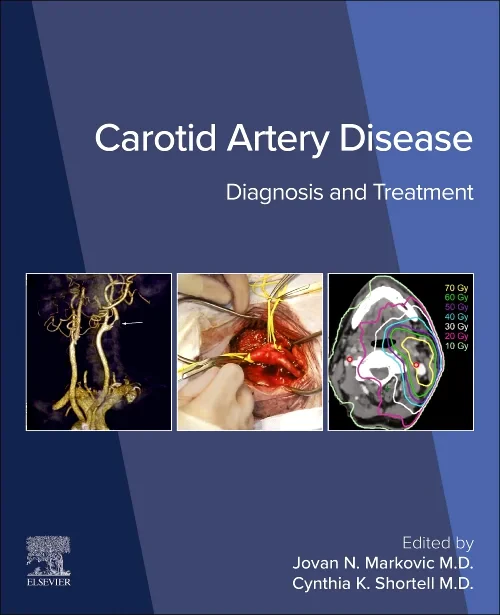 Coperta cărții "Carotid Artery Disease" de autor necunoscut