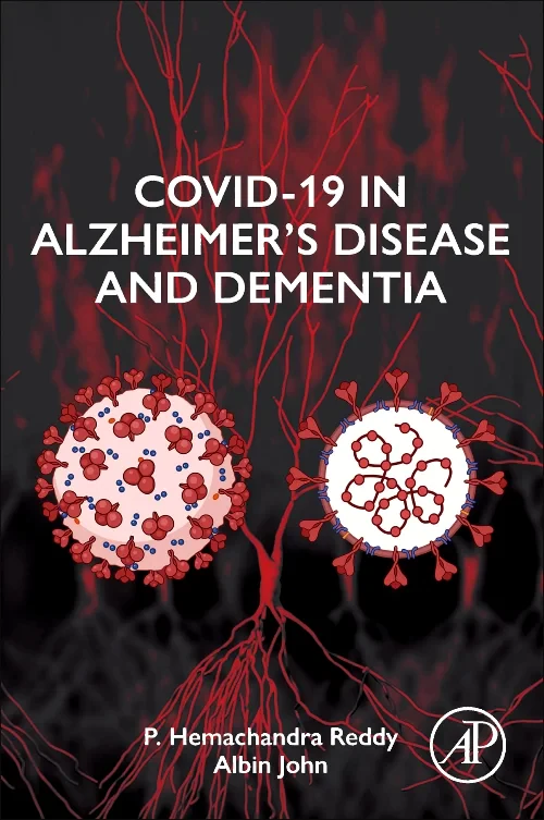 Coperta cărții "COVID-19 in Alzheimer&#039;s Disease and Dementia" de autor necunoscut