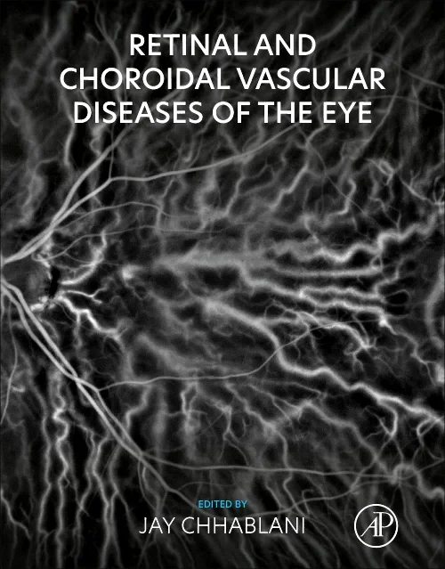 Coperta cărții "Retinal and Choroidal Vascular Diseases of the Eye" de autor necunoscut