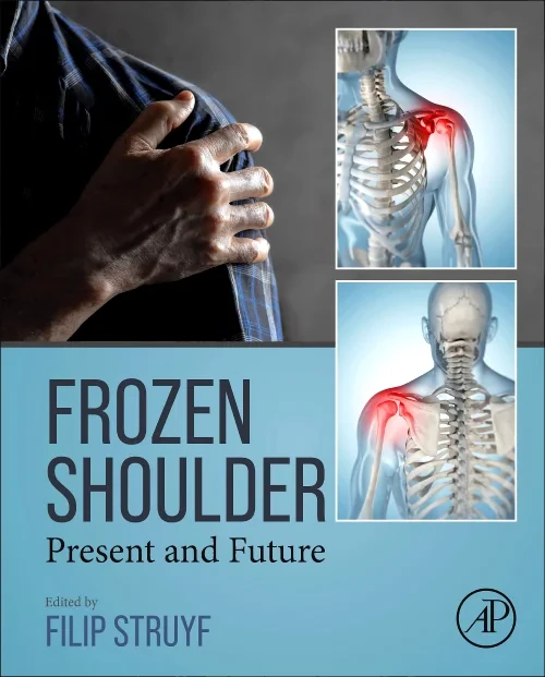 Coperta cărții "Frozen Shoulder" de autor necunoscut