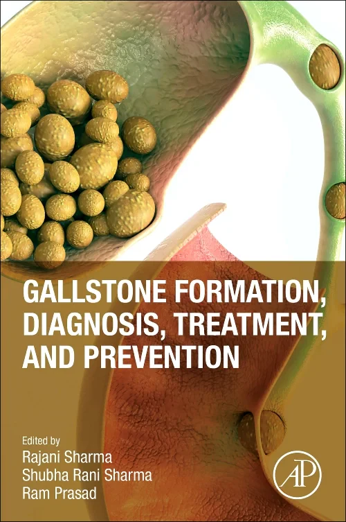 Coperta cărții "Gallstone Formation, Diagnosis, Treatment and Prevention" de autor necunoscut