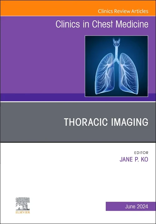 Coperta cărții "Thoracic Imaging, An Issue of Clinics in Chest Medicine" de autor necunoscut