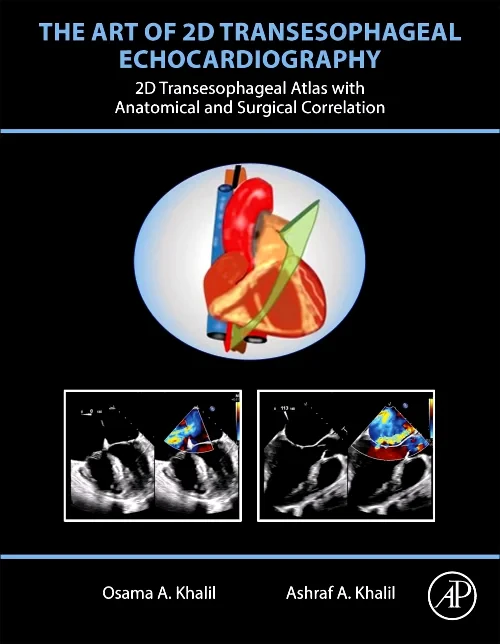 Coperta cărții "The Art of 2D Transesophageal Echocardiography" de autor necunoscut