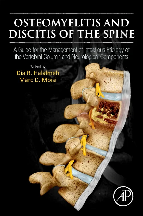 Coperta cărții "Osteomyelitis and Discitis of the Spine" de autor necunoscut
