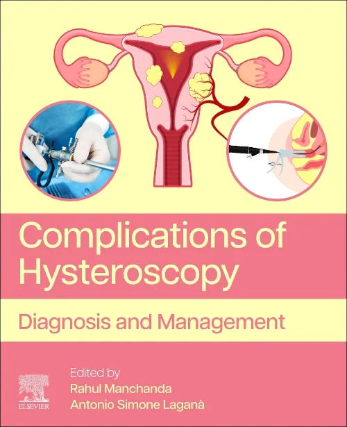Coperta cărții "Complications of Hysteroscopy" de autor necunoscut