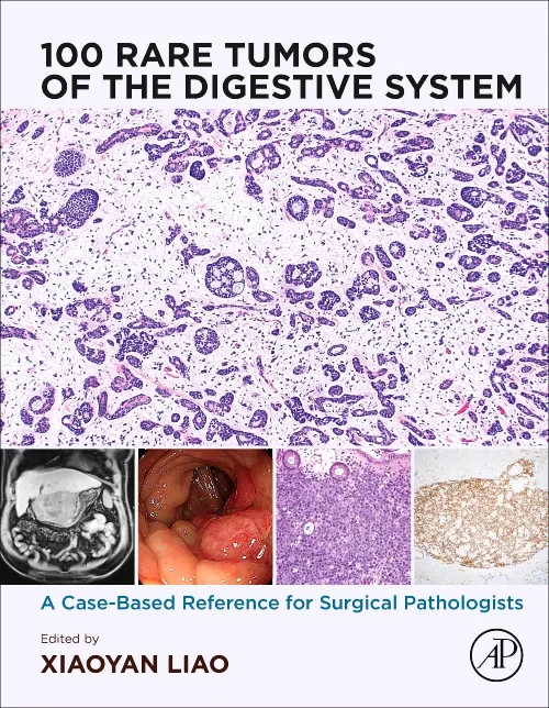 Coperta cărții "100 Rare Tumors of the Digestive System" de autor necunoscut