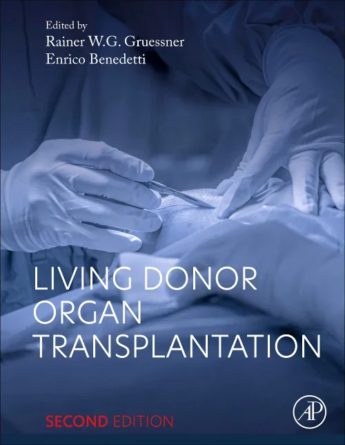 Coperta cărții "Living Donor Organ Transplantation" de autor necunoscut