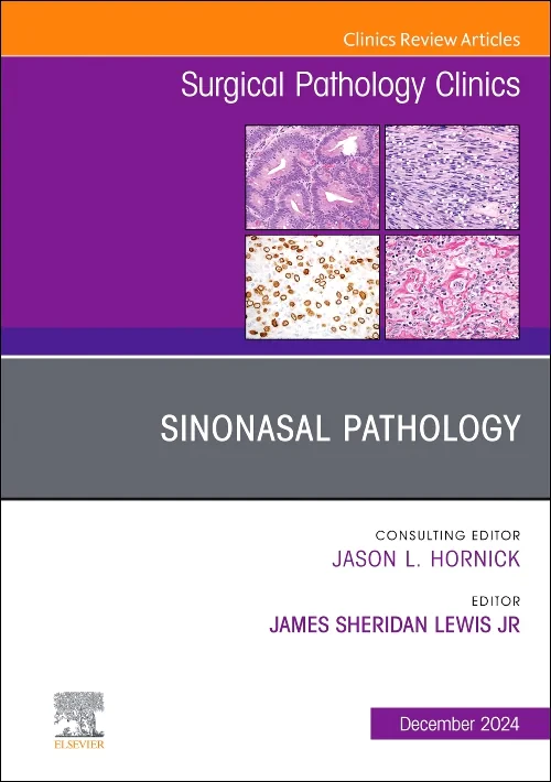 Coperta cărții "Sinonasal Pathology, An Issue of Surgical Pathology Clinics" de autor necunoscut