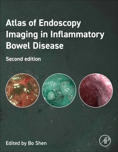 Coperta cărții "Atlas of Endoscopy Imaging in Inflammatory Bowel Disease" de autor necunoscut