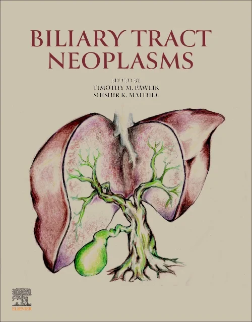Coperta cărții "Biliary Tract Neoplasms" de autor necunoscut