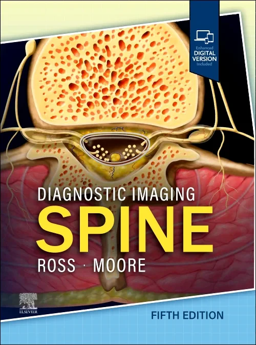 Coperta cărții "Diagnostic Imaging: Spine" de autor necunoscut