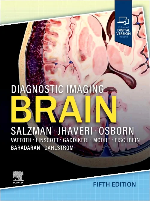 Coperta cărții "Diagnostic Imaging: Brain" de autor necunoscut