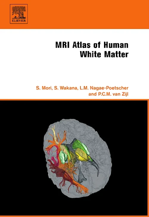 Coperta cărții "MRI Atlas of Human White Matter" de autor necunoscut
