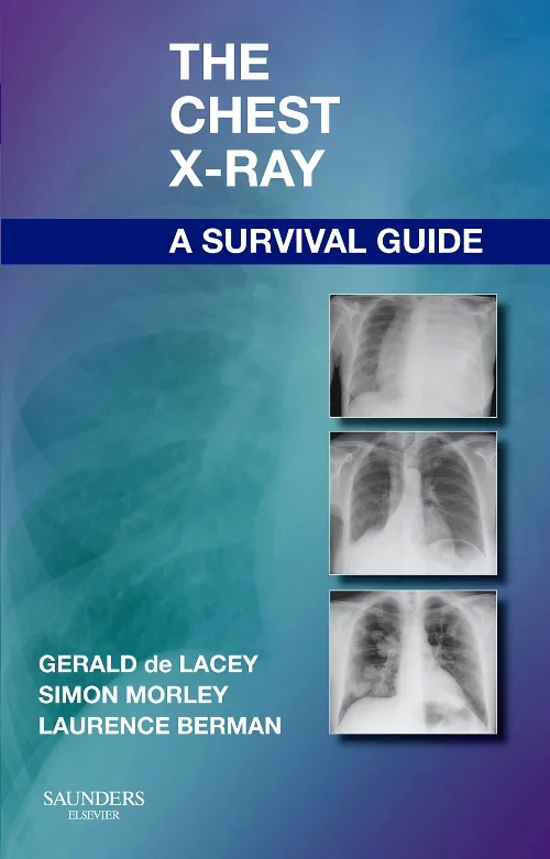 Coperta cărții "The Chest X-Ray: A Survival Guide" de autor necunoscut