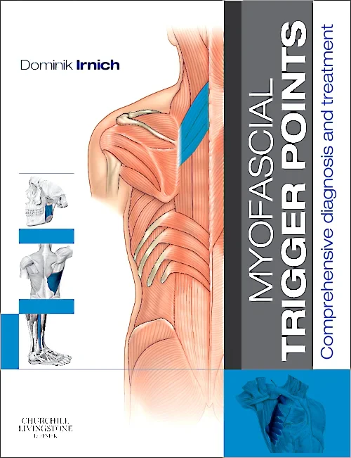 Coperta cărții "Myofascial Trigger Points" de autor necunoscut