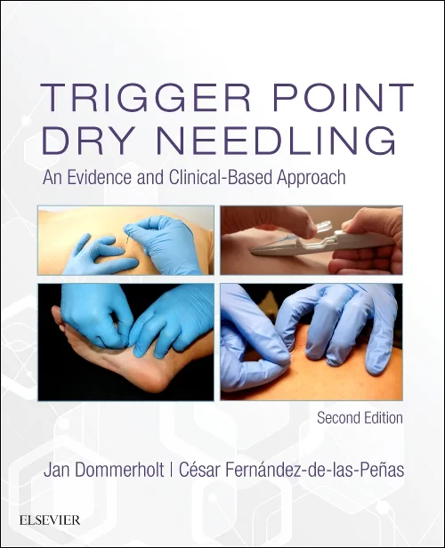 Coperta cărții "Trigger Point Dry Needling" de autor necunoscut
