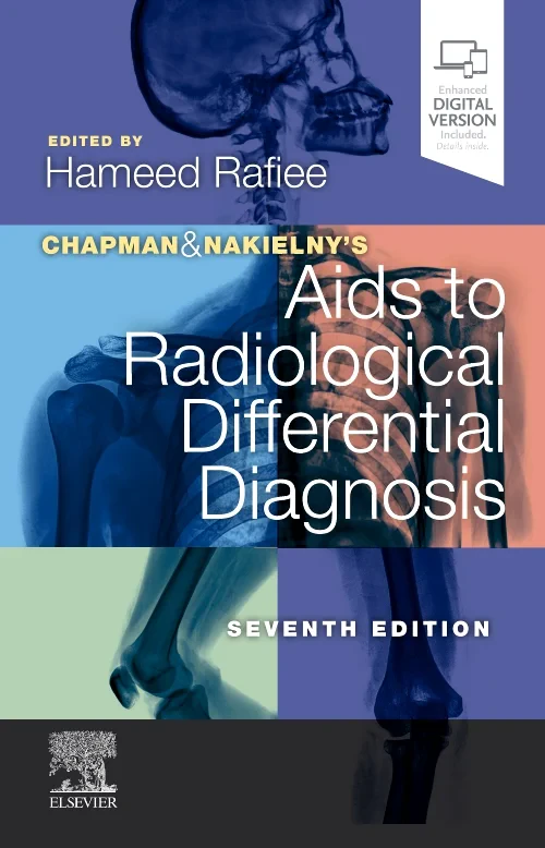 Coperta cărții "Chapman &amp; Nakielny&#039;s Aids to Radiological Differential Diagnosis" de autor necunoscut