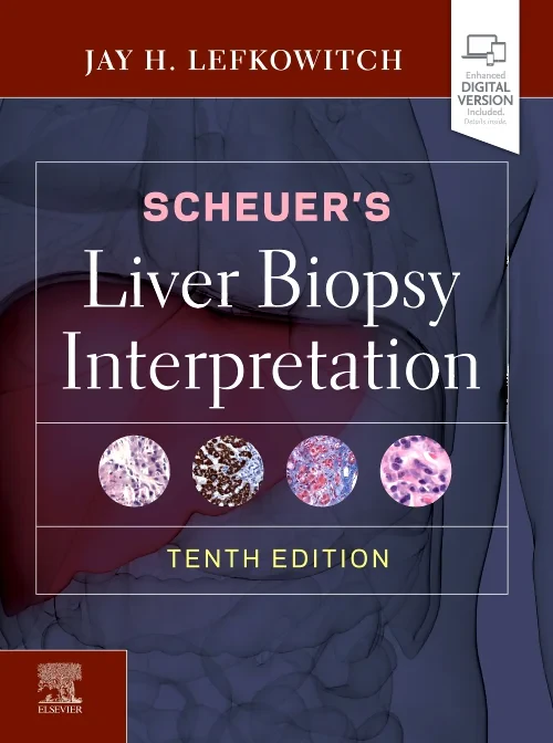 Coperta cărții "Scheuer&#039;s Liver Biopsy Interpretation" de autor necunoscut